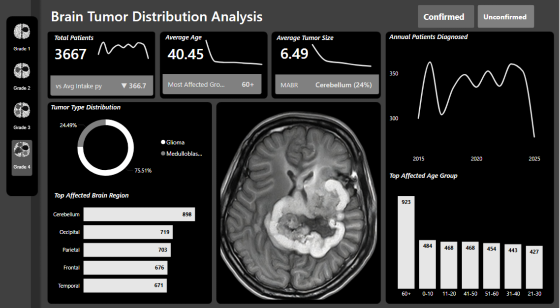 Brain Tumor Dashboard Overview